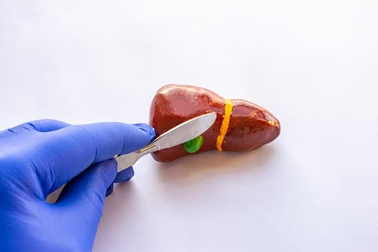 담낭 절제술