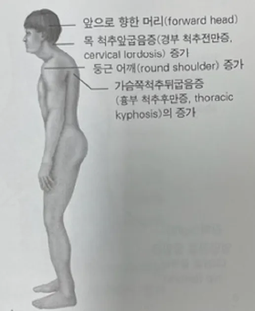 상부교차증후군자세변화