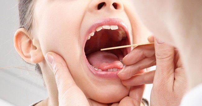 쉰 목소리 원인