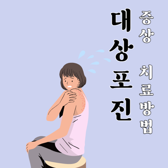 대상포진