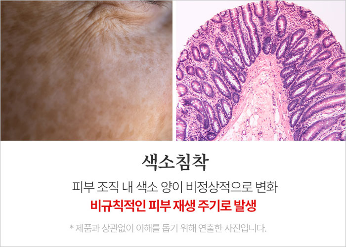 마미케어 율무크림 후기&amp;#44; 효과&amp;#44; 사용법&amp;#44; 부작용