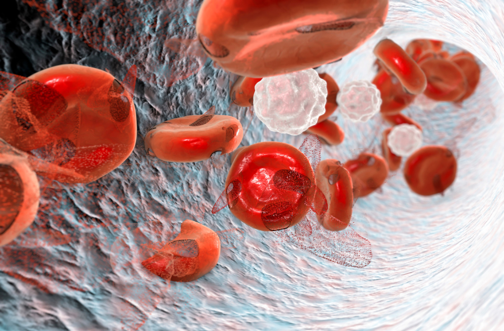 횡문근 융해증 증상 원인