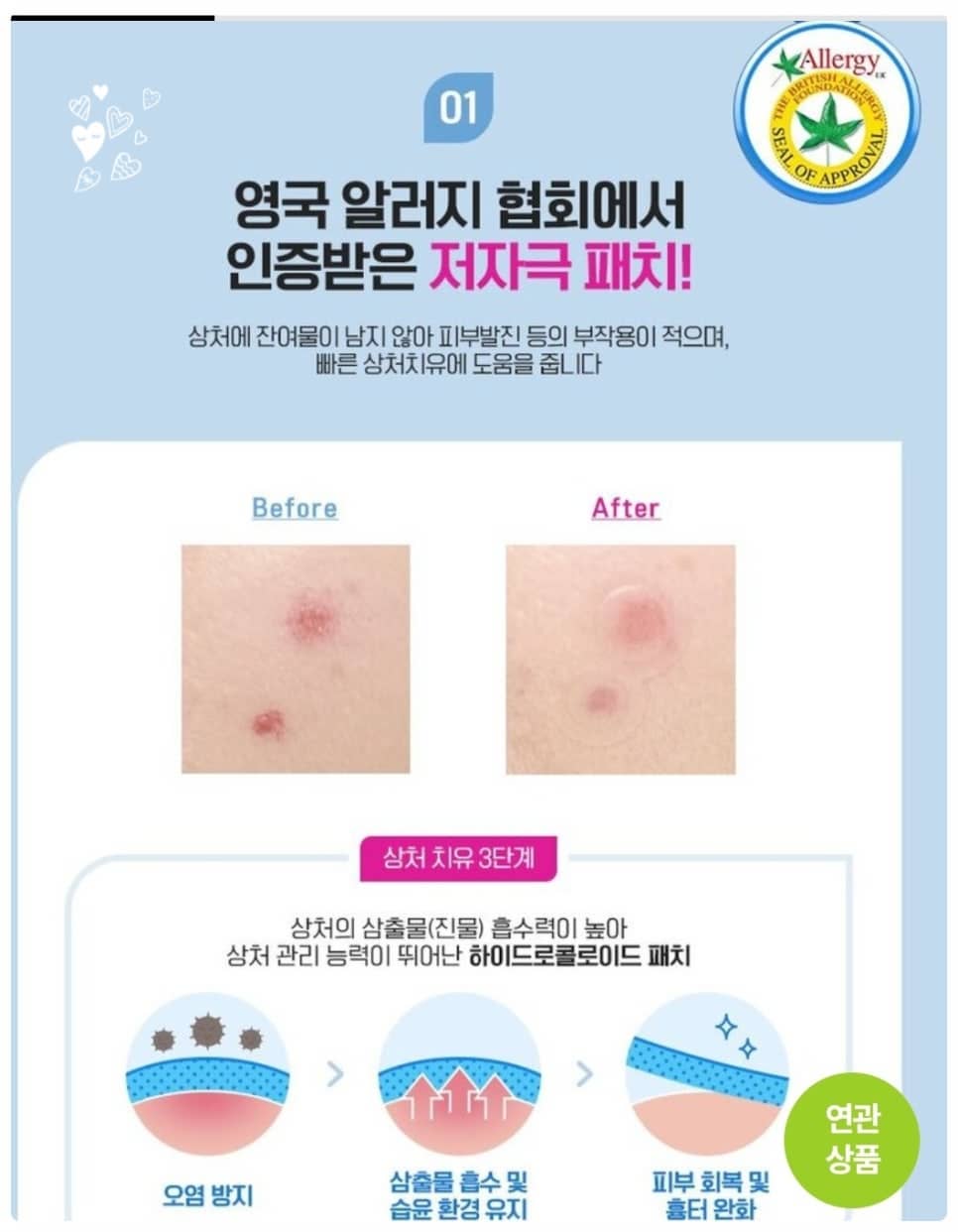 이지덤 릴리프·뷰티