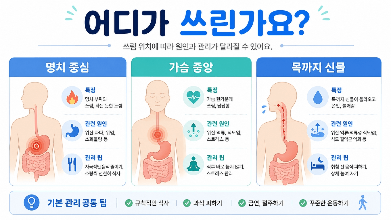위염 역류성식도염 기능성소화불량 증상 위치 비교