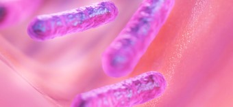 슈퍼박테리아 감염 증가 추세