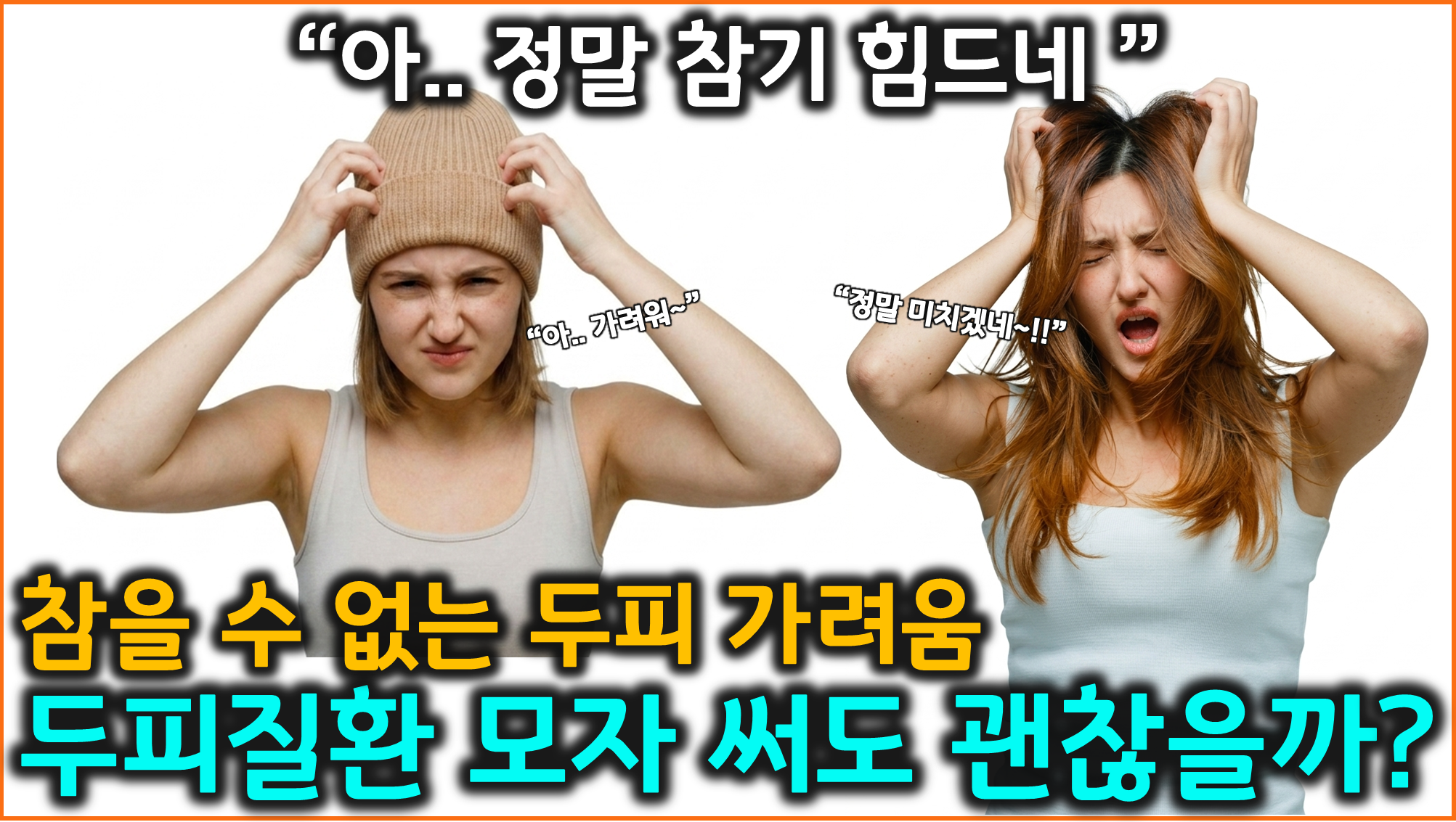 지루성 두피염 (말라세지아균, 악순환, 홈케어)