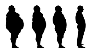 위고비 처방병원 찾는 법 총정리: 위고비 주사 가능 병원 위치와 처방가격