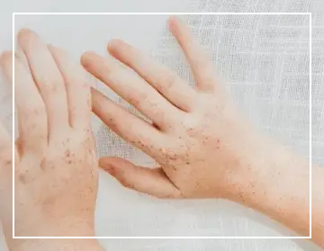 트라넥삼산과 글루타치온, 미백에 더 좋은 건? 효과·차이점 비교