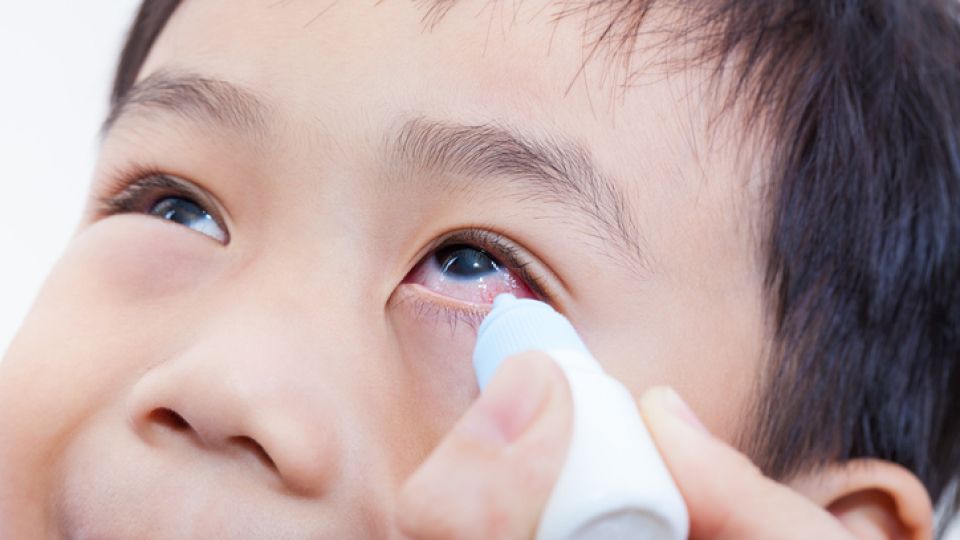 아데노바이러스 증상