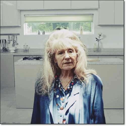 치매 초기 노인