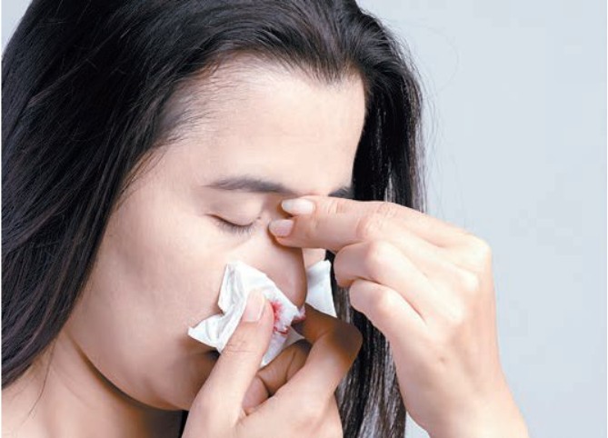 코피가-멈추지-않을때