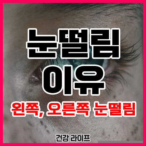 눈떨림 이유
