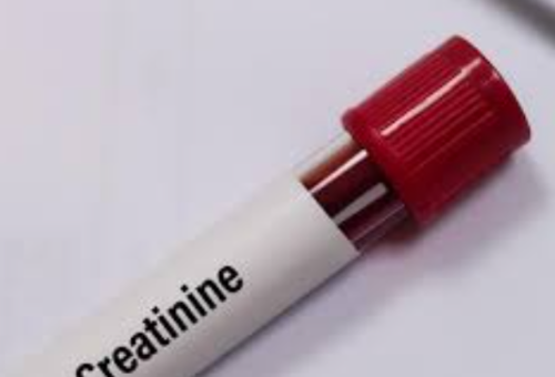 크레아티닌