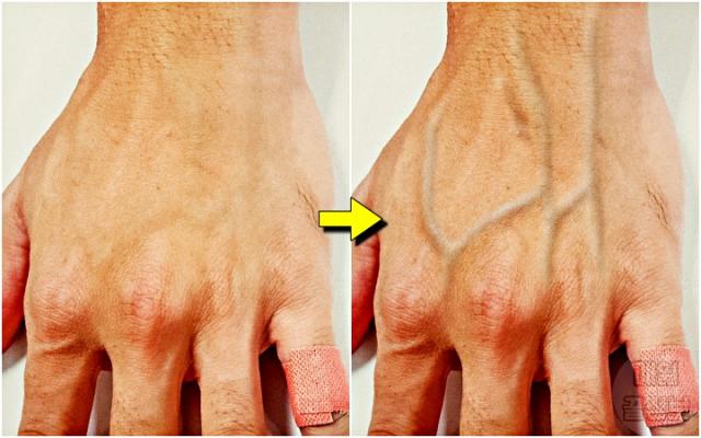 손등 핏줄 튀어나오는 이유,팁줌