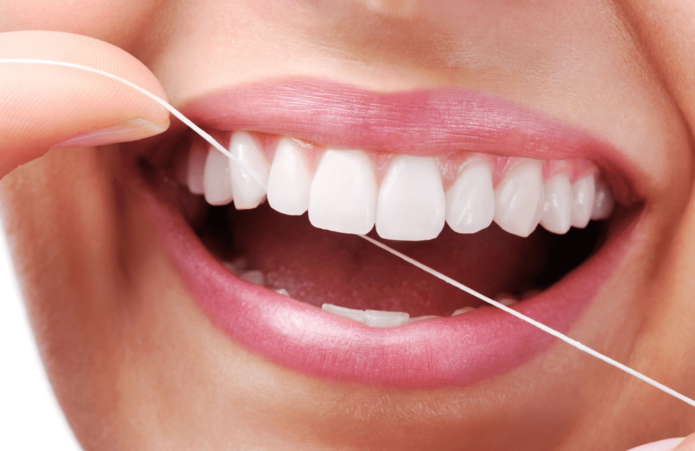 스케일링후 주의사항