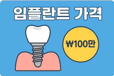 임플란트 가격