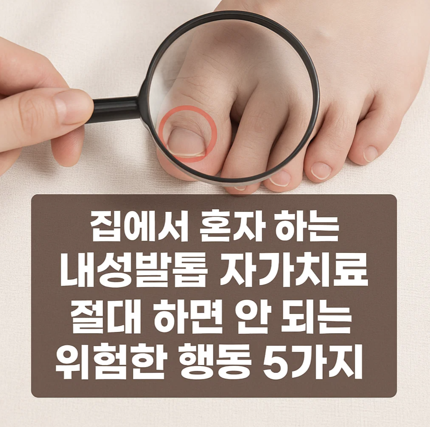 집에서 혼자 하는 내성발톱 자가치료, 절대 하면 안 되는 위험한 행동 5가지