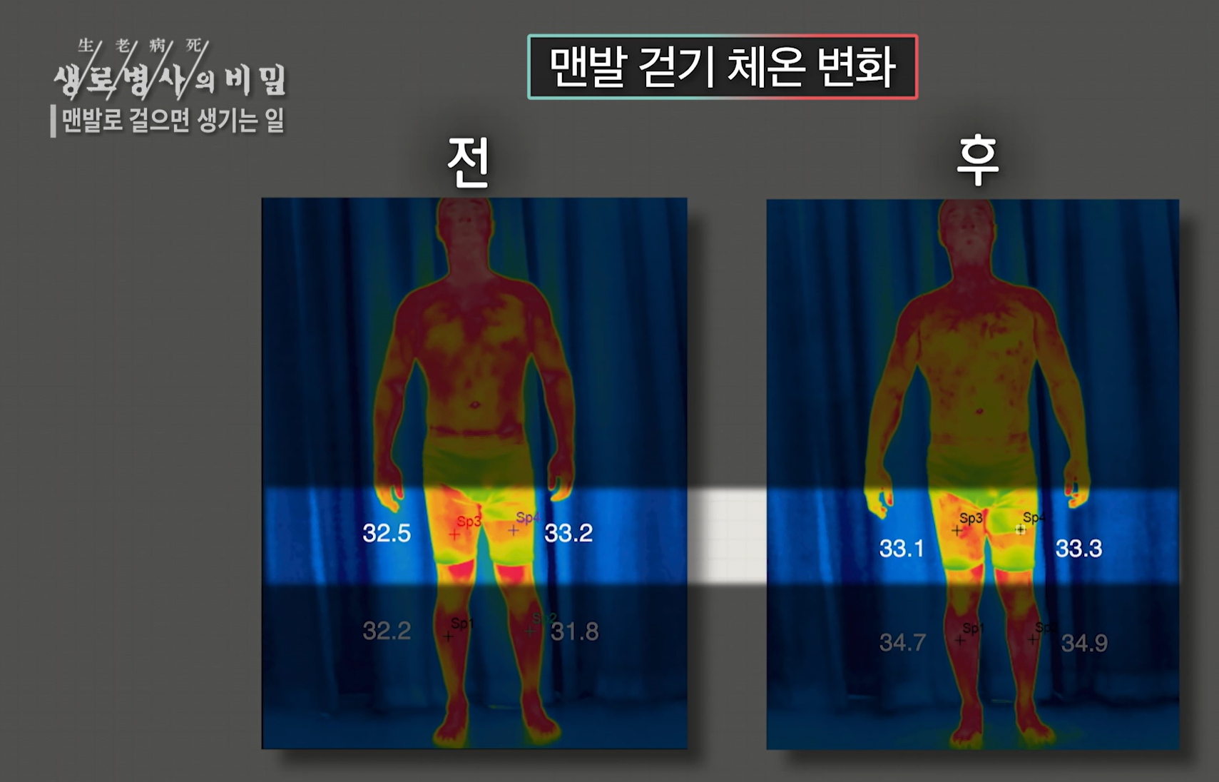 맨발 걷기 효능