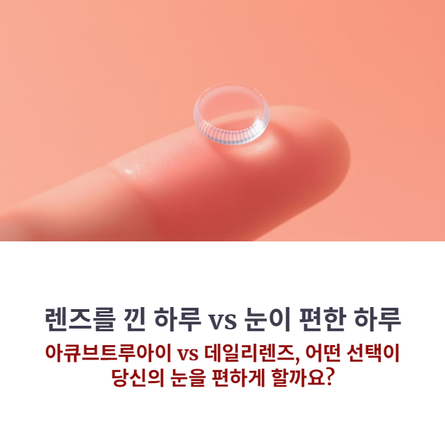 아큐브트루아이 vs 데일리렌즈 비교, 눈이 편한 쪽은?