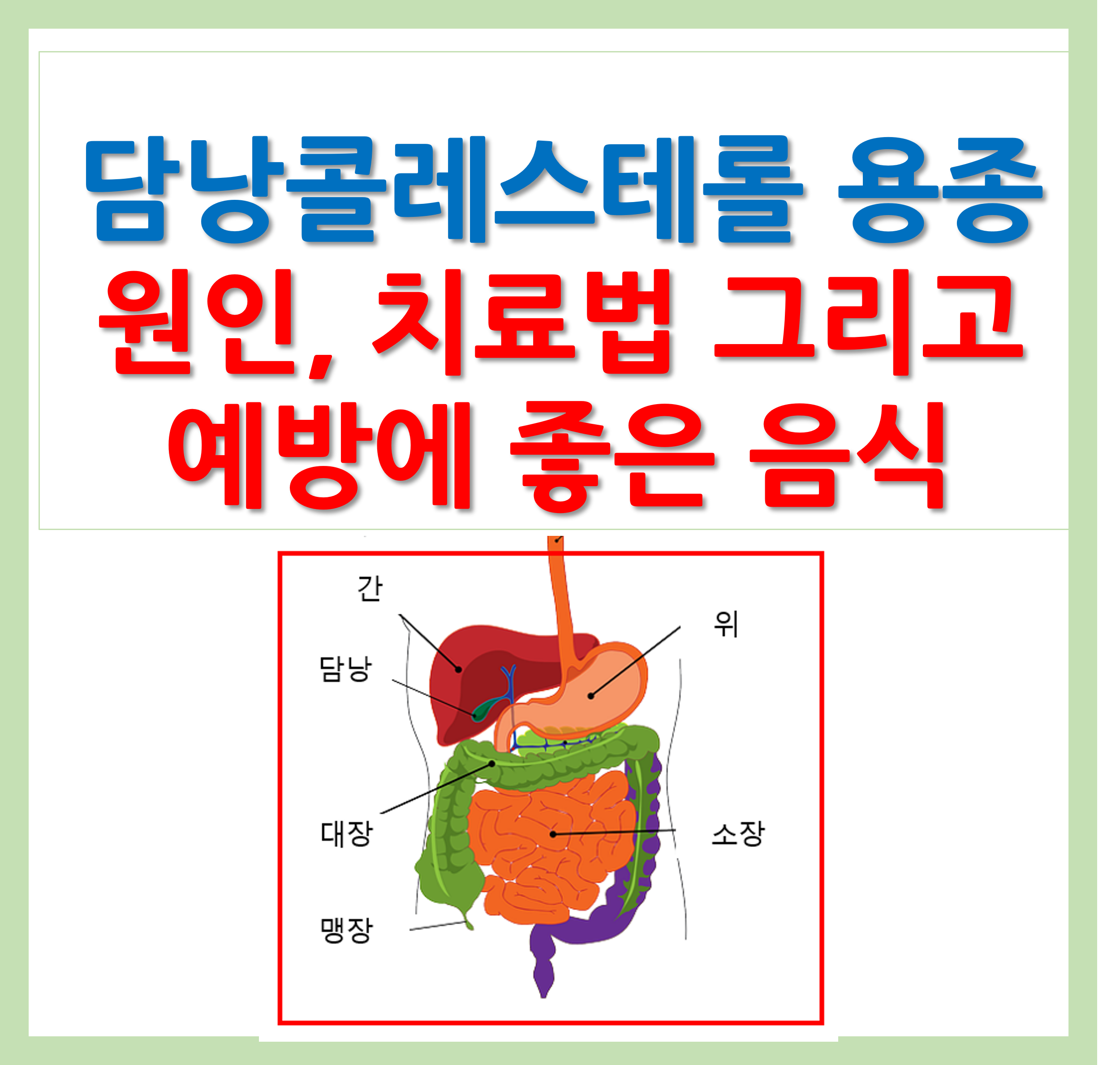 담낭콜레스테롤 용종 치료법 및 좋은 음식