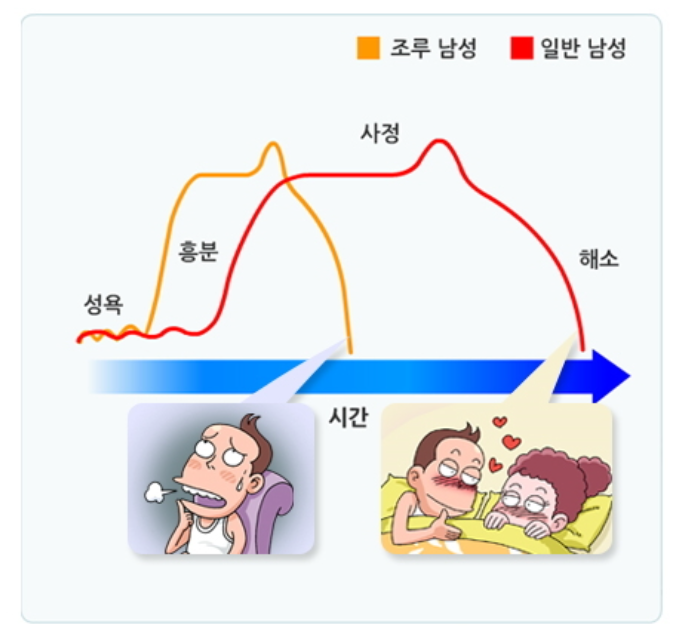 조루증