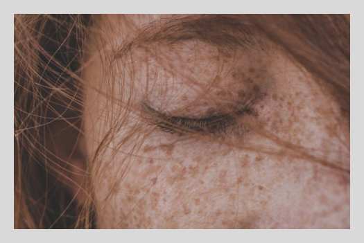 점뺀후 재생테이프 붙이는 기간