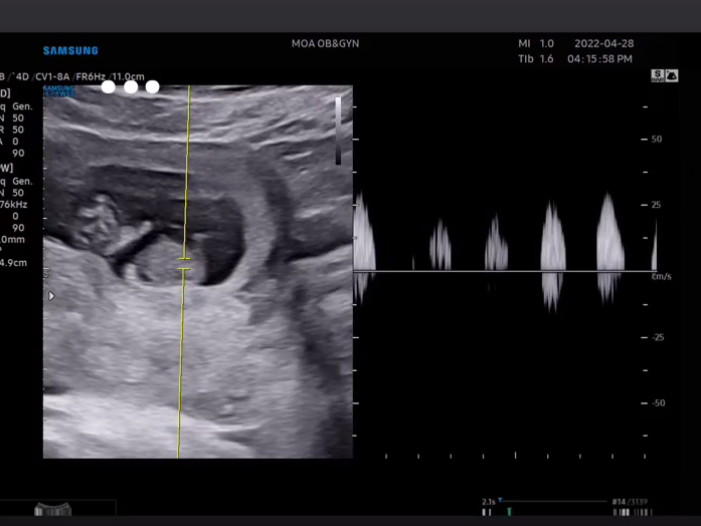이재은 임신사진