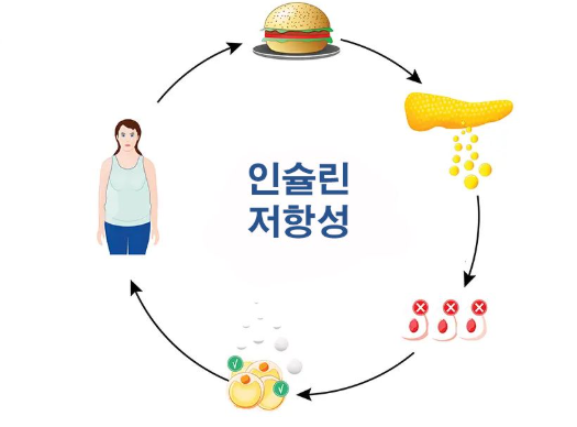 인슐린 저항성 해결법 뱃살과 당뇨를 잡는 간헐적 단식 비법