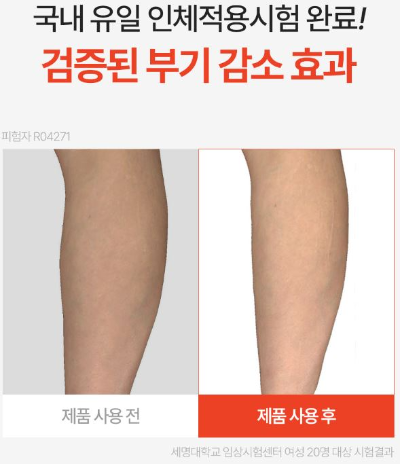 스파알권은비종아리다리마사지기