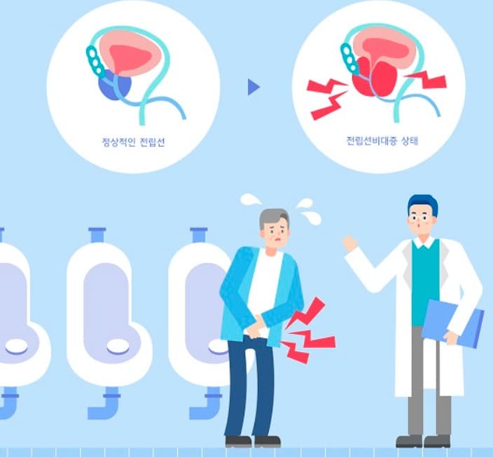 전립선 비대증 치료약