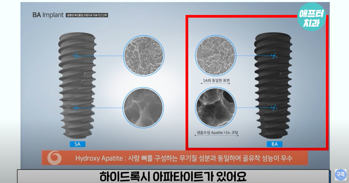 하이드록시 아파타이트