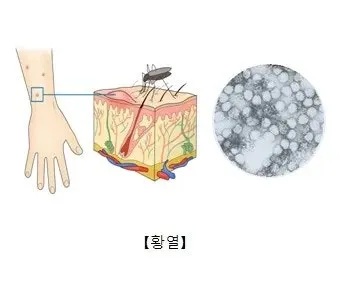 남미 황열병 예방접종 후기 경험과 준비사항_4