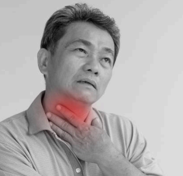 역류성 식도염 이미지사진