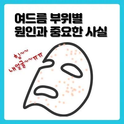 여드름-부위별-원인과-중요한-사실