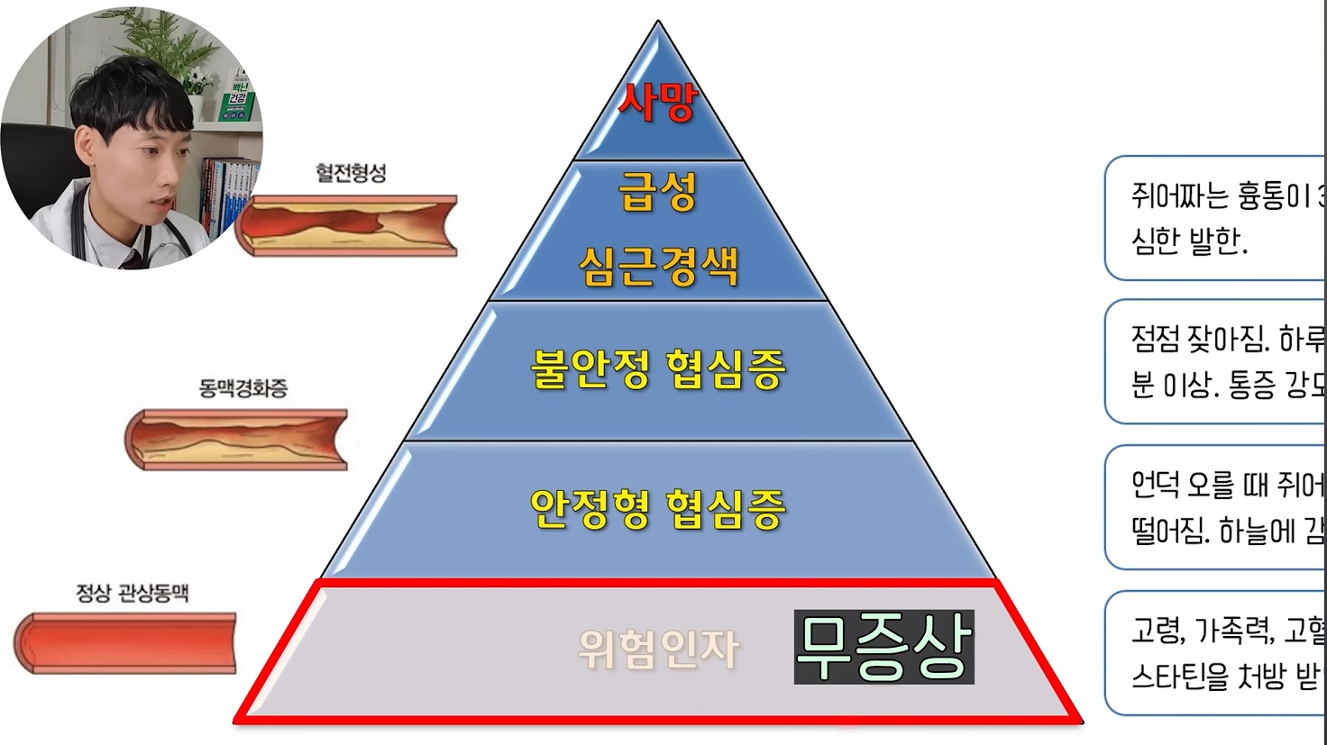 급성-심근경색-안영근-교수