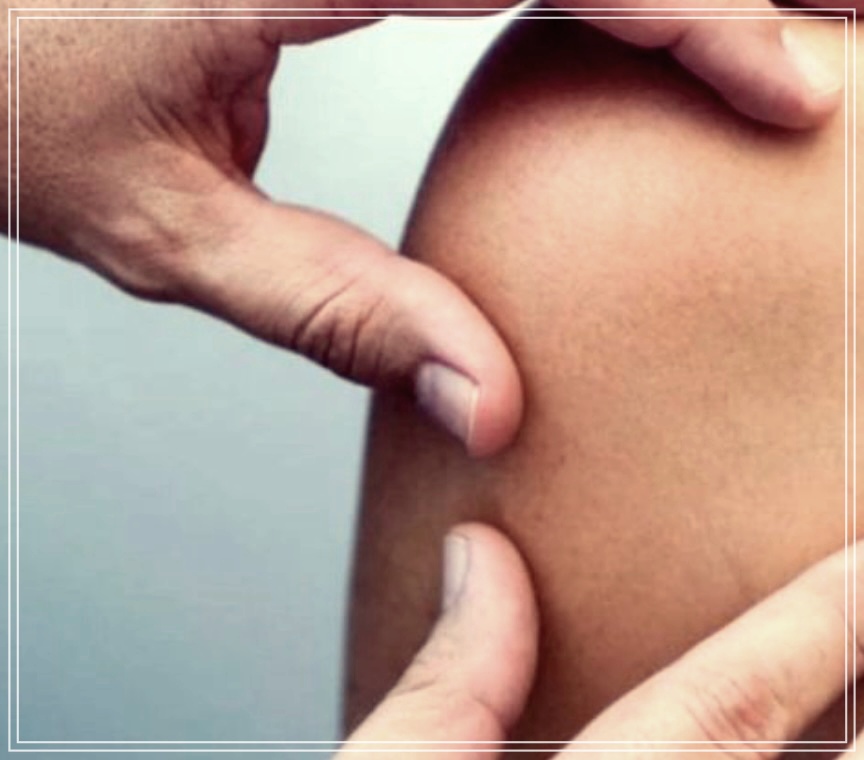 얼굴 지방종 제거 방법