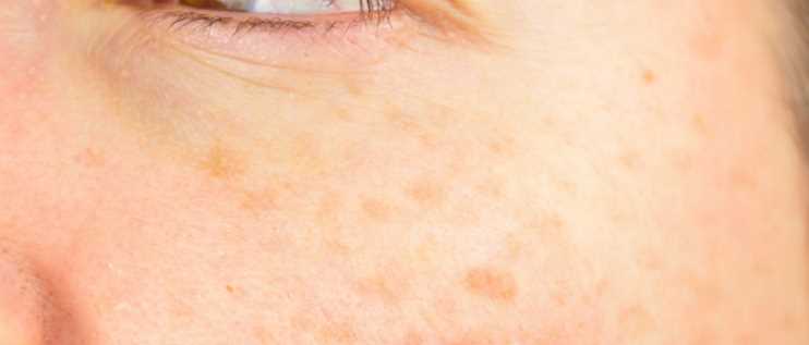 유자차 효능 - 피부건강 개선