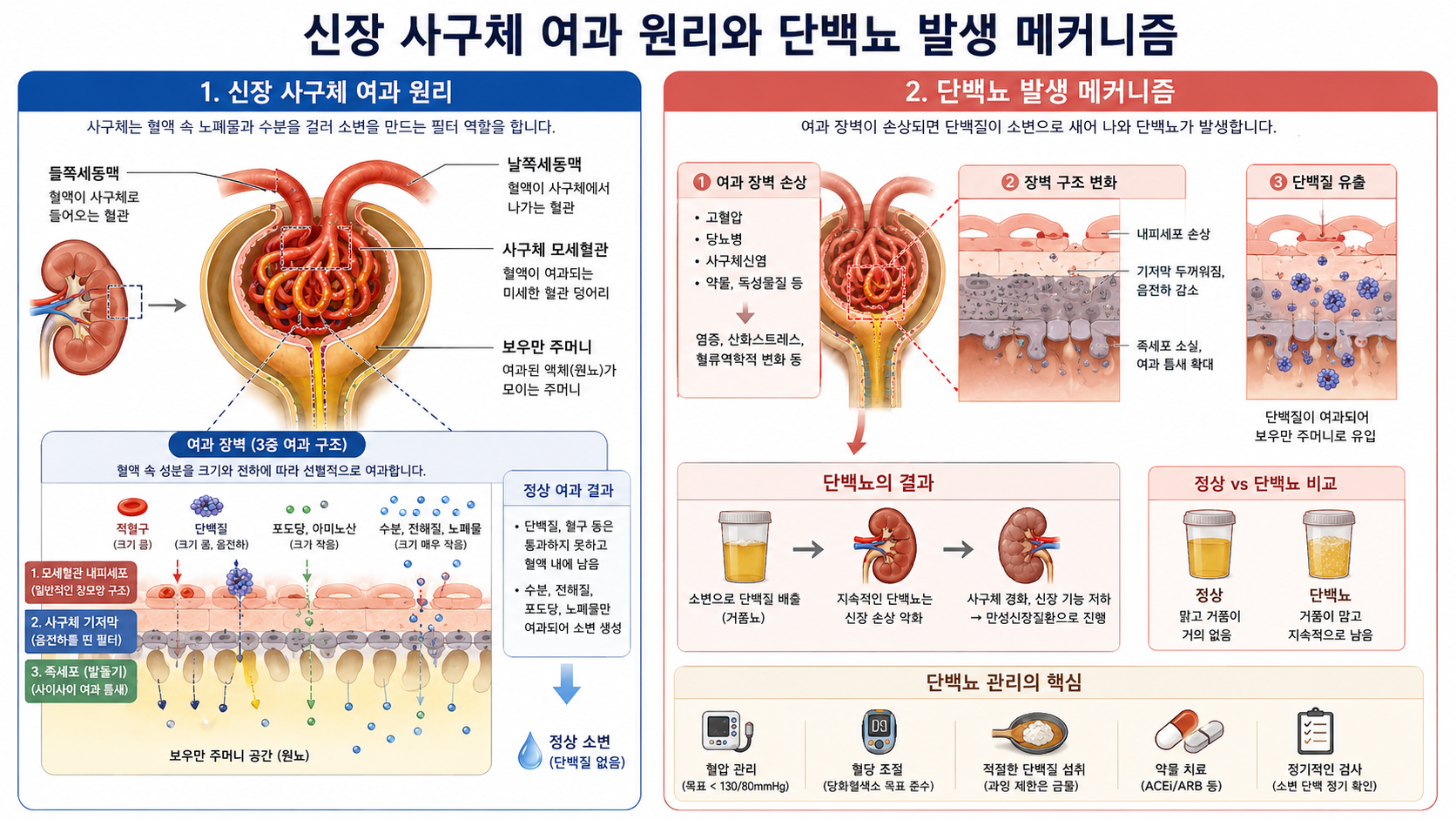 소변검사에서 단백뇨가 나왔을 때 의미