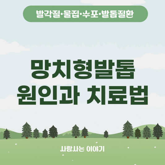 클럽핑 발톱(망치형), 폐질환과 연관이 있을까? 원인과 치료법, 자가 관리법