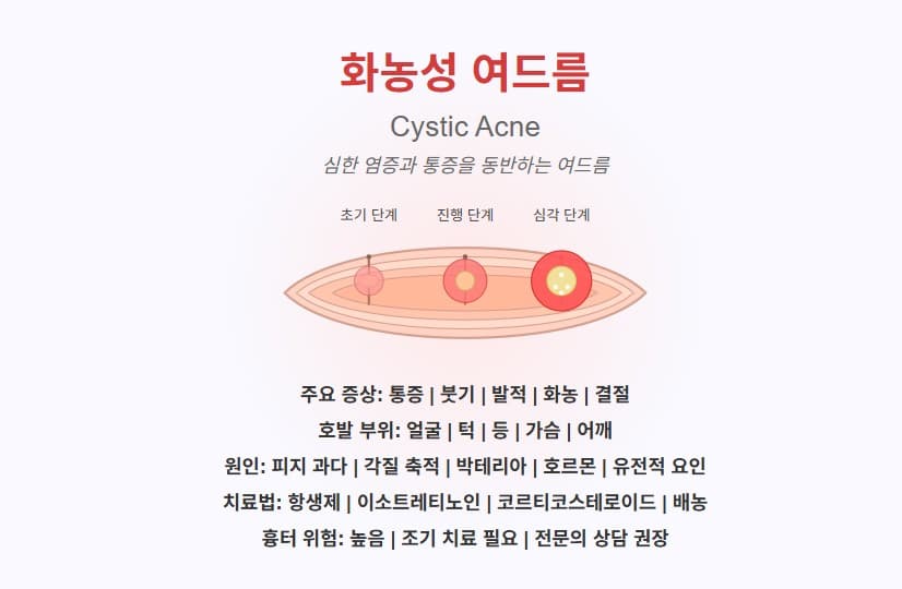 화농성 여드름 완벽 가이드