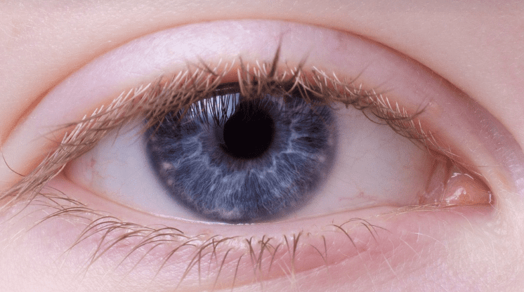 결막염 관련 안과 사진4