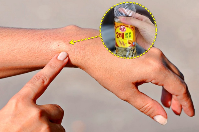 명절 성묘 말벌 쏘였을때 응급처치법, 생활 팁줌 매일꿀정보