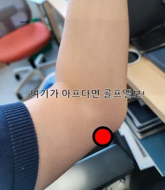 팔꿈치 통증 원인 6가지증상운동법예방법치료법까지_22