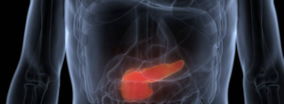 췌장암 초기증상 검사방법 생존율 알아보자!