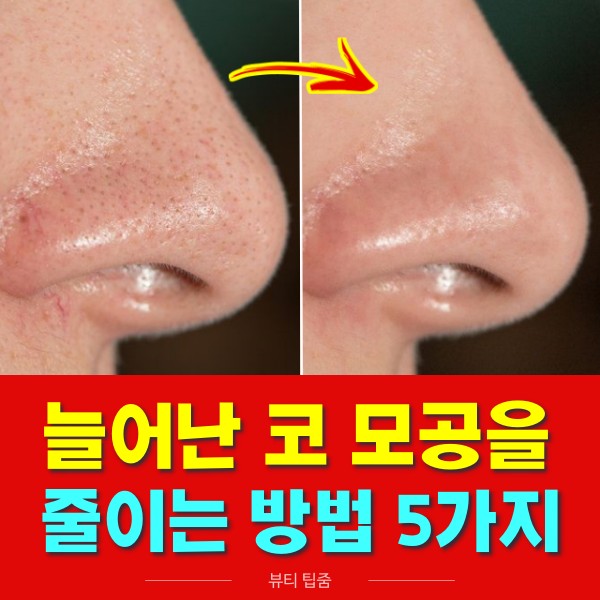 자연적으로 코 모공 줄이는 방법,모공축소 시술 없이,뷰티 팁줌 매일꿀정보