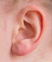 청력 보호