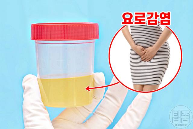 소변색깔 건강상태,소변색깔이 뿌옇다,소변거품