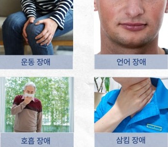 근위축성 측색경화증 ALS