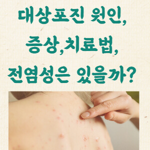 대상포진 초기증상&#44; 원인