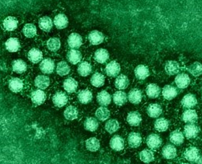 엔테로바이러스